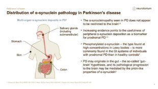 Parkinsons Disease – Neurobiology and Aetiology – slide 13
